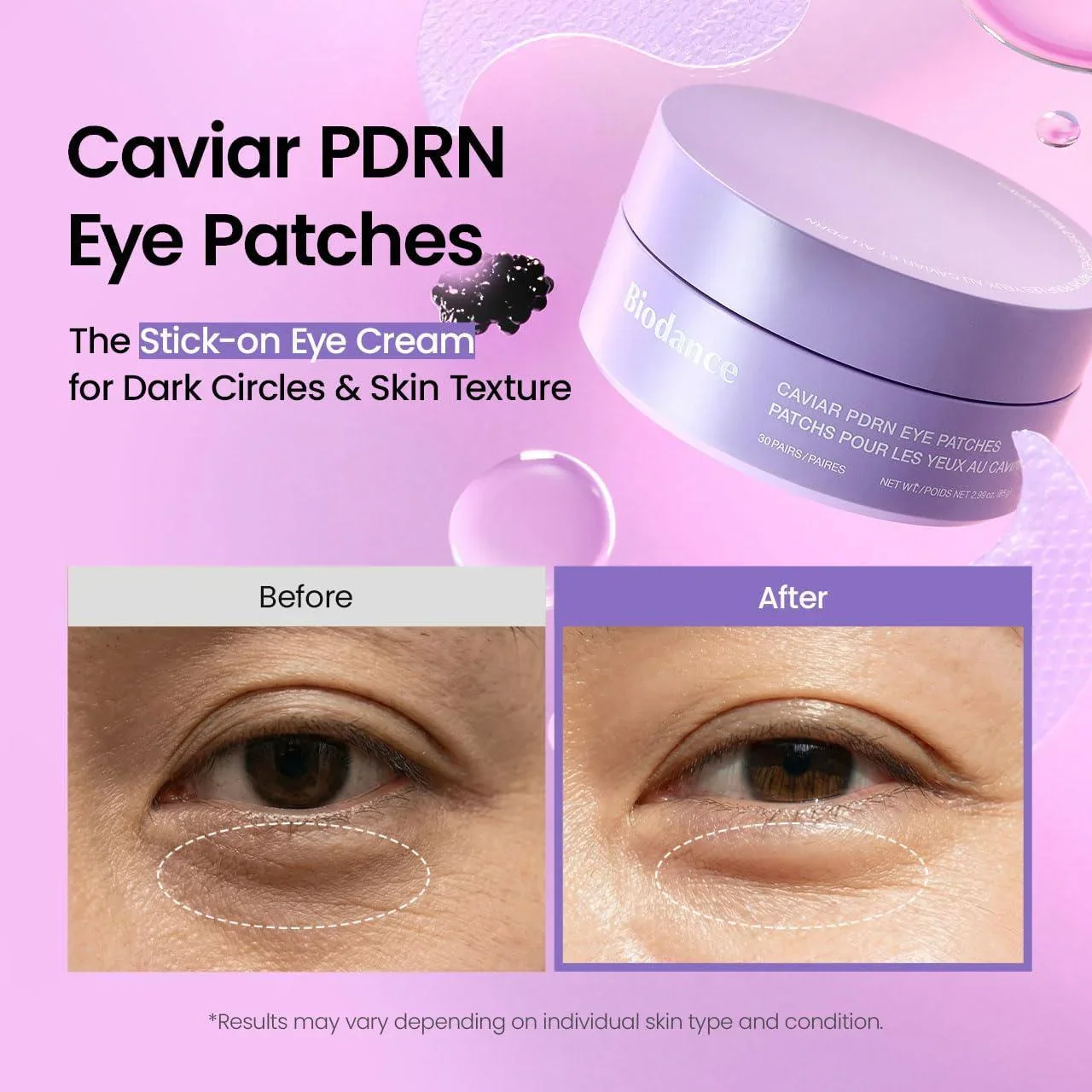 Biodance Caviar PDRN Eye Patches (30pcs) - Image 3