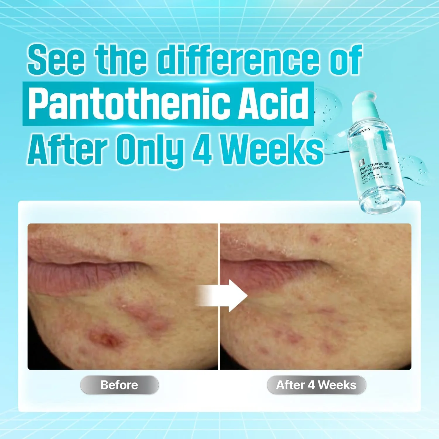 Numbuzin No.1 Pantothenic B5 Active Soothing Serum 50ml - Image 5