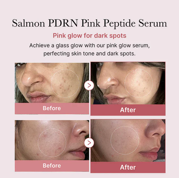 MEDICUBE PDRN Pink Peptide Serum 30ML - Image 5