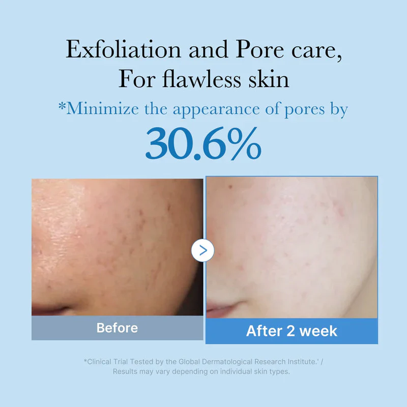 MEDICUBE Zero Pore Toner 250mL - Image 5